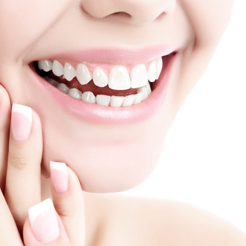 Blanqueamiento dental vs. carillas: ¿Cuál es la mejor opción estética en Terrassa? 1 https://ikonicdental.com/terrassa/blanqueamiento-dental-vs.-carillas:-cual-es-la-mejor-opcion-estetica-en-terrassa