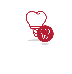 Cirugía e implantes dentales en Terrassa