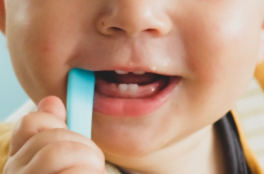 ¿Cuánto dura la carrera y la especialidad de Odontopediatría?