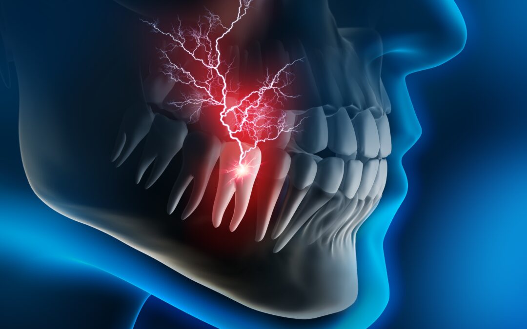 ¿Cuánto tiempo dura el dolor de una endodoncia?