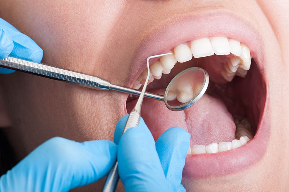 ¿Cuánto cuesta el tratamiento periodontal, una cirugía de encías, y una cita con el periodoncista en España?