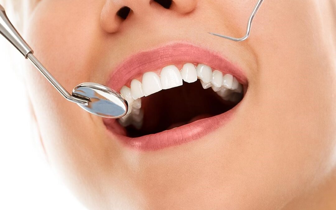 ¿Cuánto dura una sesión de periodoncia y cuánto tiempo dura un tratamiento de periodoncia completo?